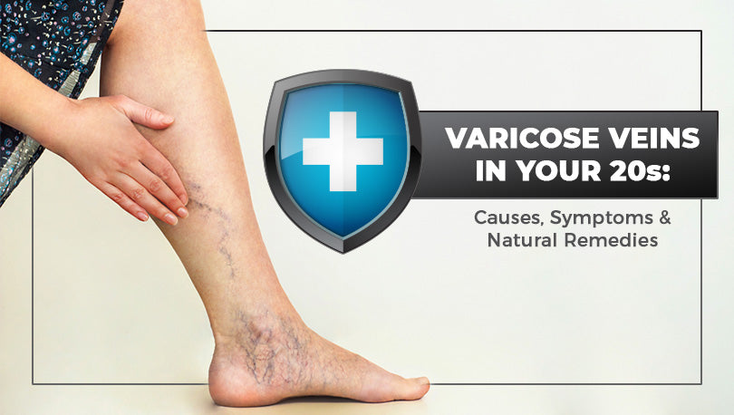 Varicose Veins in Your 20s: Causes, Symptoms & Natural Remedies